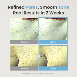 The Face Shop - Suero Niacinamida 10% - Serum Corrector de Manchas, Control de Grasa y Perfeccionador de Poros – Suero para Imperfecciones Antimanchas con Niacinamida, Unifica Tono, Suaviza e Ilumina, 30Ml
