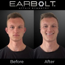 EARBOLT - Adhesivos para corregir orejas | Correctores cosméticos de orejas, paquete de 20