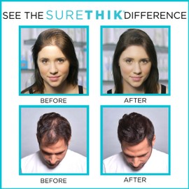 SureThik Hair Thickening Fiber Starter Package - With Application Tools - Comes with 1 x 15g Hair Fiber, 1 x 3oz Holding Spray, 1 x Hair Fiber Spray Applicator & 1 x Hairline Tool (Dark Brown)