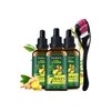 Aceite Para El Crecimiento Del Cabello Vedora King Of Ginger