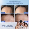 Forehead Wrinkle Patches: Collagen Anti Wrinkle Patches-Moisturising Anti-Ageing Treatment, 12