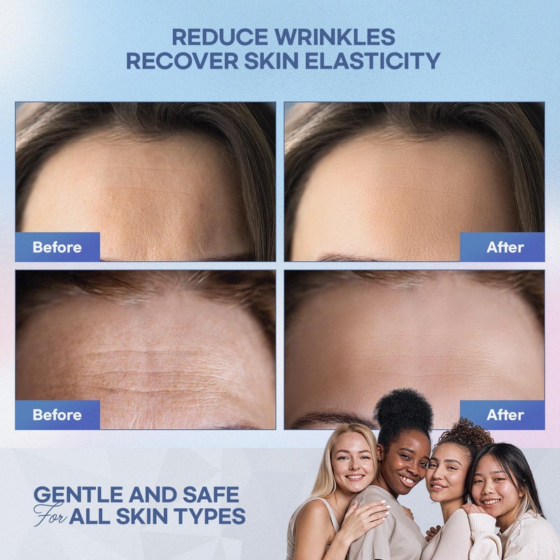 Forehead Wrinkle Patches: Collagen Anti Wrinkle Patches-Moisturising Anti-Ageing Treatment, 12