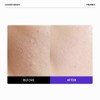FRANKLY [FRANKLY]Closer Serum 60ml