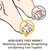 Welnove 6Pcs Hammer Toe Straightener, Hammer Toe Splints, Toe Cushioned