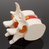 APHRODITE Spine Model, 1:1.5 Size, Herniated Disc Model, Movable (White)