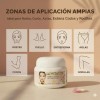Crema Lupita Original 50ml Anti Manchas Acne Facial Axila Ca