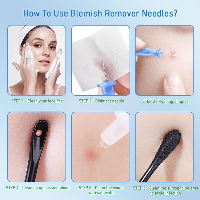 100 Pcs Disposal Blemish Remover Needles, Painless Pimple Popper for