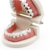 Dental Caries Study Tool Adult Standard Typodont Demonstration Teeth Model