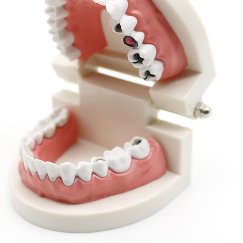 Dental Caries Study Tool Adult Standard Typodont Demonstration Teeth Model