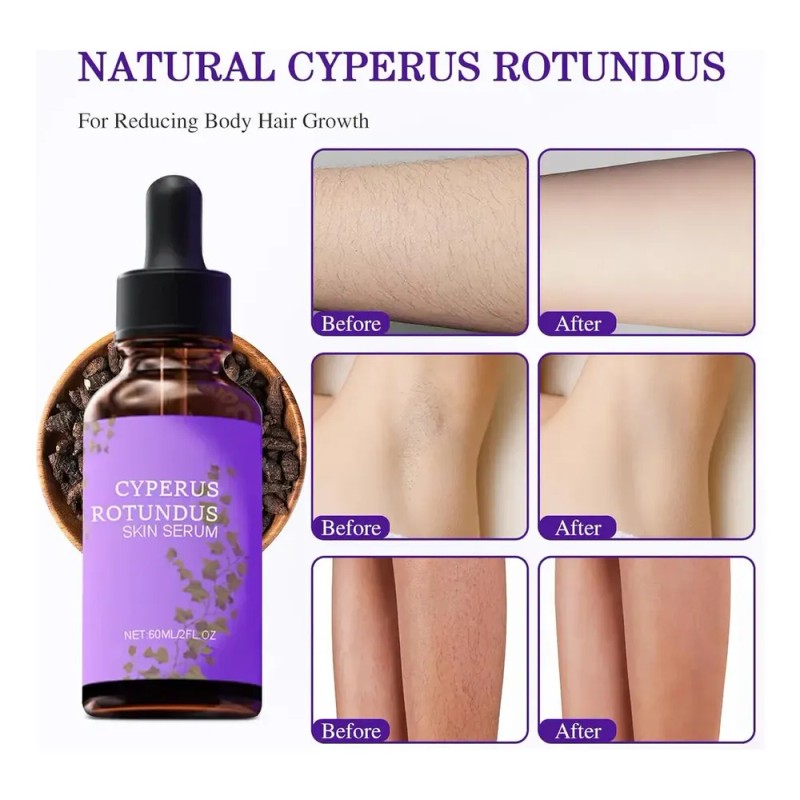 F Cyperus Rotundus Oil For Depilation &amp; Hydration C