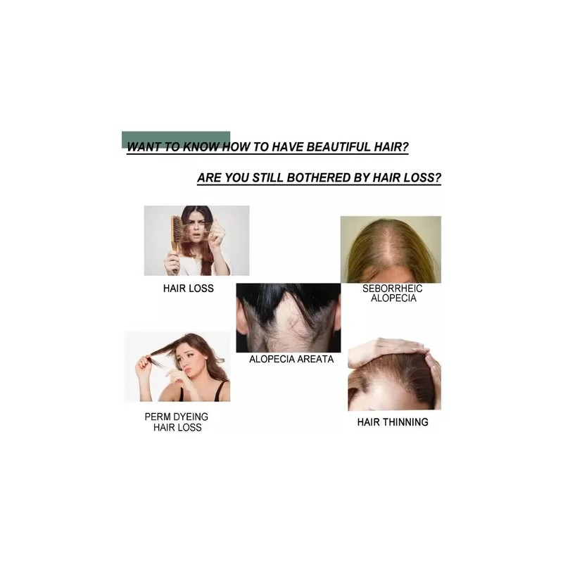 Tratamiento Regenerativo Cabello Calvicie Caida Natural 30ml