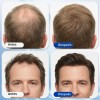 Suero Capilar Para Crecimiento Cabello 3% Romero 1.01 Oz