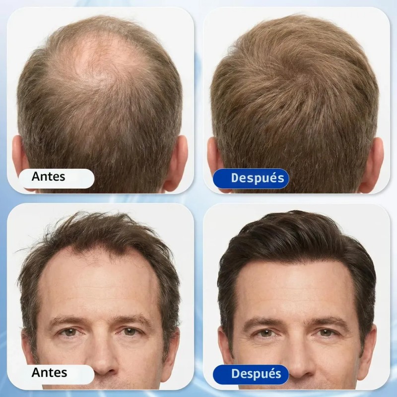 Suero Capilar Para Crecimiento Cabello 3% Romero 1.01 Oz