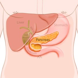 Biotherapy Chronic Inflammation of The Pancreas with Pancreatic Insufficiency Kit