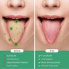 TOPOST Limpiador Raspador de Lengua, Tongue Scraper con Estuche