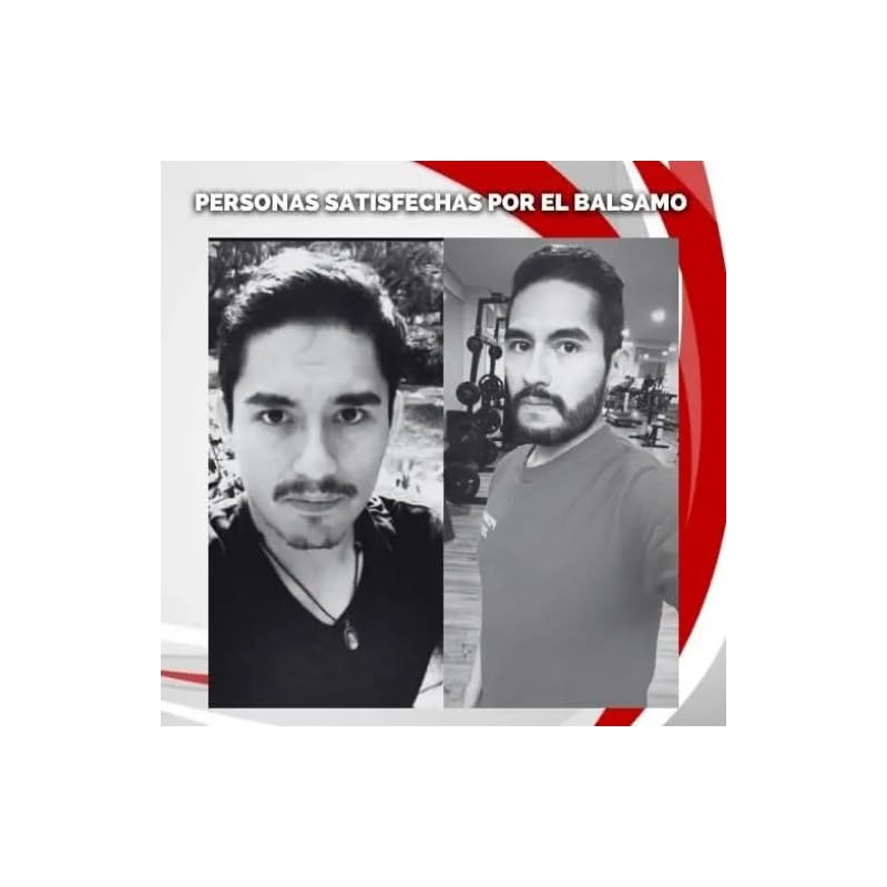 Kit Tratamiento 3 Meses para Barba Escasa y con Huecos