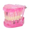 Transparent Adult Teeth Model Pathological Repair Studying Dental Teaching Tools