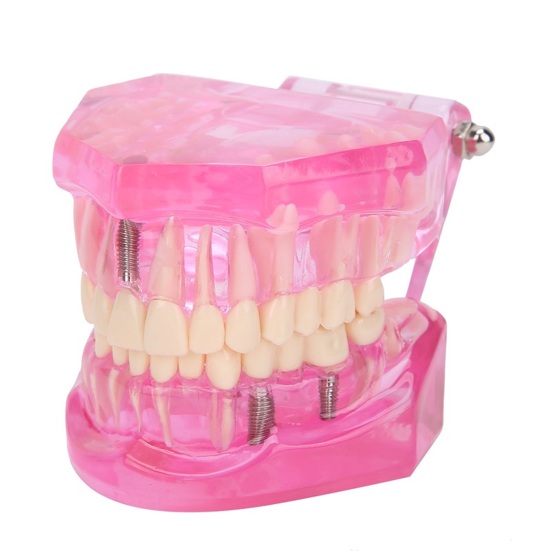 Transparent Adult Teeth Model Pathological Repair Studying Dental Teaching Tools