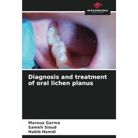 Diagnosis and treatment of oral lichen planus