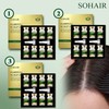 So Hair So Hair Full Scalp Ampoule (7mlx 8ea) x 3 boxes / 쏘헤어 쏘헤어 헤어풀 두피 앰플 (7mlx 8개) x 3박스