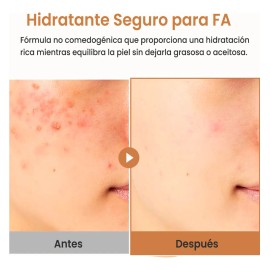 Purito Oat In Calming Gel Cream 100ml Crema De Avena En Gel Sensible Día/noche