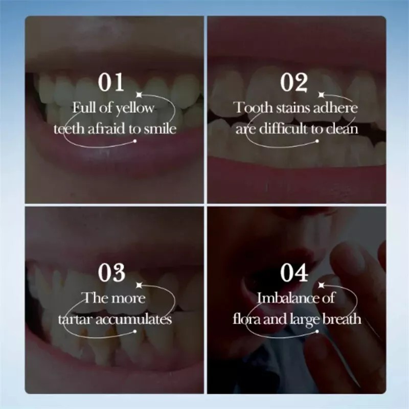 Unbranded Hydroxyapatite Toothpaste Toothpaste Cleaning Gingival Toothpaste Tooth Care To