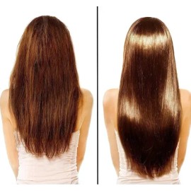 Biotina Aceite Tratamiento Cabello Sano Largo Evita Caida                                                                                             