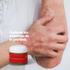 Pomada Natural de Caléndula 60g - Altamente Concentrada. Cictrizante para