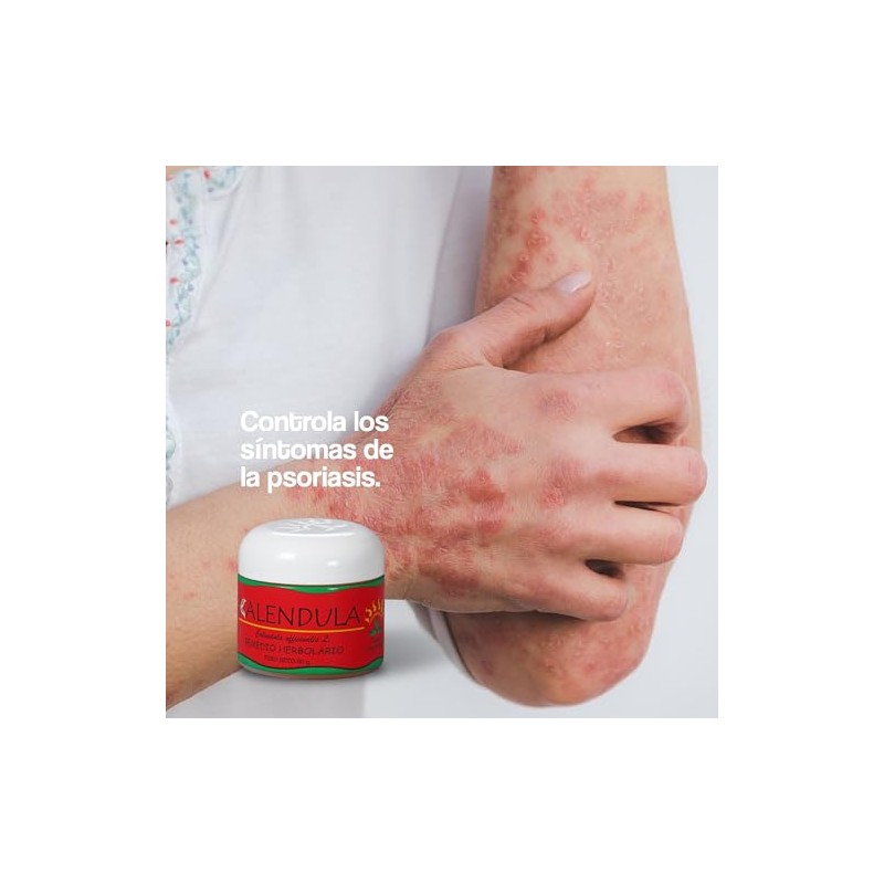 Pomada Natural de Caléndula 60g - Altamente Concentrada. Cictrizante para
