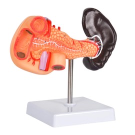 Simedutech Pancreas Spleen Anatomy Model, Normal