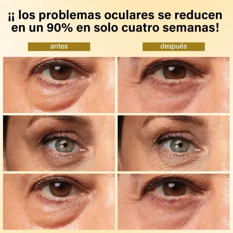 Kit 2 Roll On Anti Ojeras Y Bolsas Mirada Fresca