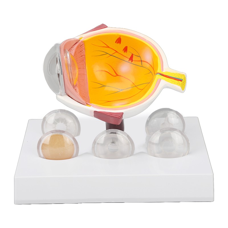 Enlarged Human Eye Anatomical Model Accurate Shows Optic Nerves Cornea