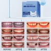 Temporary Veneers Kit for Women and Men, Tooth Replacement Kit,