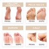 Exfoliating foot mask, foot peeling, foot peel mask, foot masks,