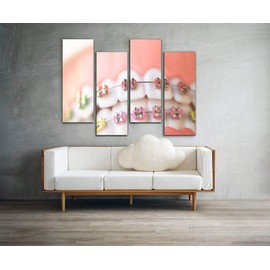 Wocatton cosmetic dentistry orthodontics dental metal wire teeth brackets Wall Art Background Decor Pictures Print On Canvas Art Stretched and Framed Perfect Home Decoration