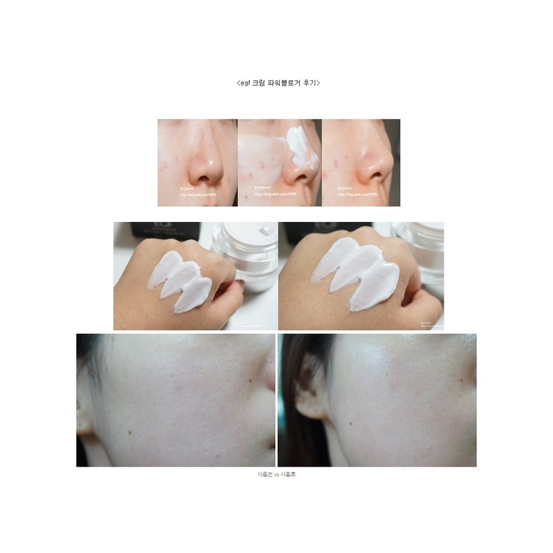 Beauty Med EGF Day Cream 50ml / 뷰티메드 EGF 데이