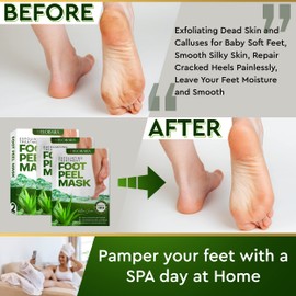Foot Peel Mask, 2 Pack, Exfoliating Dead Skin and Calluses for Baby Soft Feet, Smooth Silky Skin, Repair Cracked Heels Painlessly, Leave Your Feet Moisture and Smooth…