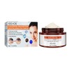 Cream to remove fat under the eyes and improve sagging under the eyes / 눈밑 지방 제거 눈밑 꺼짐 처짐 개선 크림