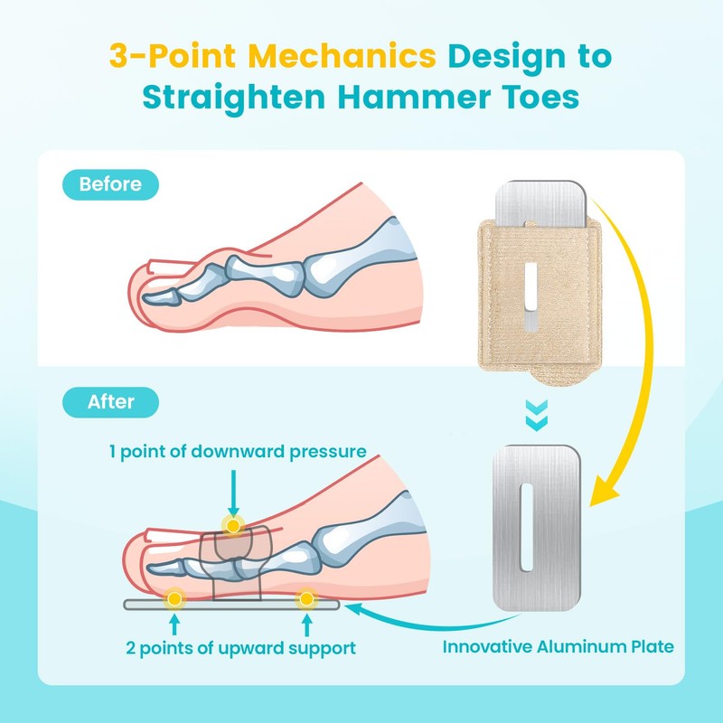 Pozpo Tech Hammer Toe Straighteners Toe Correction Splint for Women
