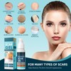 Scar Gel, Scar Cream, Advance Scar Gel for Surgical Scars