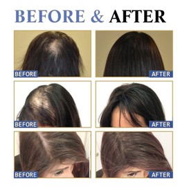 2pcs Sea/Puri Scalp Serum,Scalp Cooling Hair Roll-on Massage Essence,Hair Serum for Hair Loss,Scalpy Hair Growth Serum for Men & Women,Strengthening Soothing Hair Essences,Improves Shine