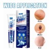 Crema Remove Verrugas,elimina Verrugas Corporales Y Faciales