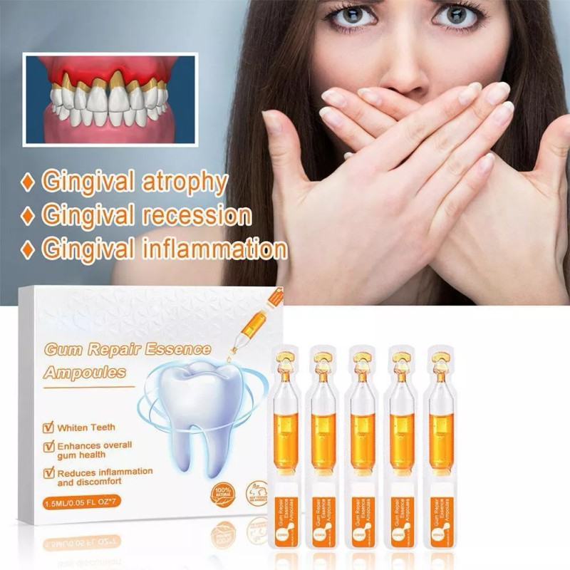 generic 14 Piezas De Gel Dental Para Restauración
