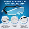 Post-LASIK Eye Shields: Comfortable Protective Sleeping Eye Shield Goggles