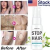 Permanent Hair Removal Spray Natural Painless Stop Hair Growth Inhibitor