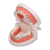 Dental Typodont Teeth Model with Orthodontic Metal Bracket for Dentist