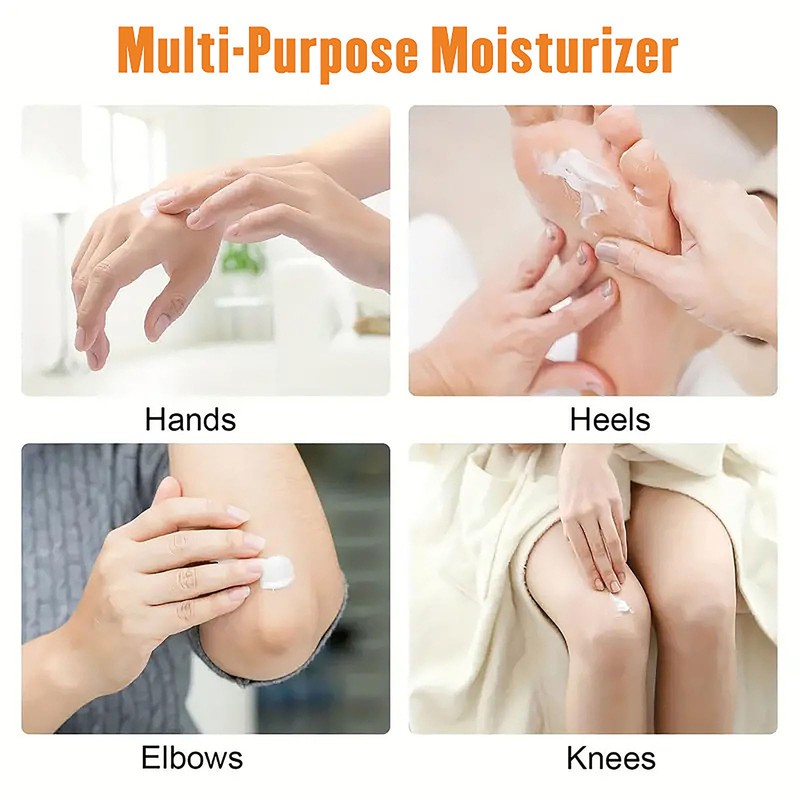 60% Urea Cream with 2% Salicylic Acid, Urea Cream 60