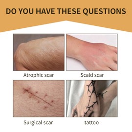 Tattoo Cover Up Tape, 6 PCS Flesh-Colored Ultra Thin Patches for Concealing Tattoos, Scars, Birthmarks, Invisible, Waterproof, and Breathable Makeup Skin Tone Concealer Stickers for Flawless Coverage