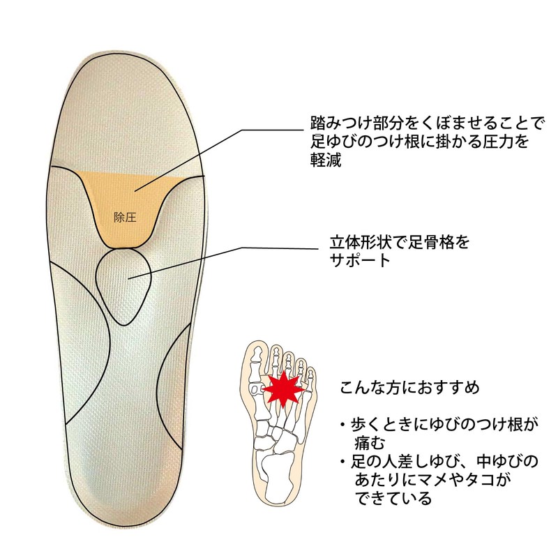 Shoesfit.com(シューズフィットドットコム) 村井 インソールプロ(靴用中敷き) 中足骨頭部痛対策 レディス・女性用 S(22~22.5cm)