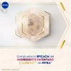 NIVEA Luminous630® Serum Aceite Corporal Anti-estrías 100ml